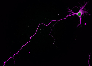 A nerve cell showing its characteristic polarity: The cell body sends one long axon in one direction, while branch-like dendrites sprout in others. (Photo: Sara Parker) A nerve cell showing its characteristic polarity: The cell body sends one long axon in one direction, while branch-like dendrites sprout in others. (Photo: Sara Parker)
